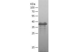 Western Blotting (WB) image for Solute Carrier Family 16 (Monocarboxylic Acid Transporters), Member 3 (SLC16A3) (AA 406-465) protein (His-IF2DI Tag) (ABIN7125153) (SLC16A3 Protein (AA 406-465) (His-IF2DI Tag))