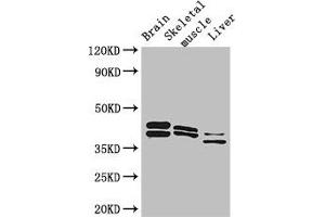 Western Blot Positive WB detected in: Mouse brain tissue, Mouse skeletal muscle tissue, Mouse liver tissue All lanes: ALDOC antibody at 3 μg/mL Secondary Goat polyclonal to rabbit IgG at 1/50000 dilution Predicted band size: 40 kDa Observed band size: 40, 36, 42 kDa (ALDOC antibody  (AA 190-354))