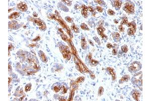 Immunohistochemistry (IHC) image for anti-Cystic Fibrosis Transmembrane Conductance Regulator (ATP-Binding Cassette Sub-Family C, Member 7) (CFTR) antibody (ABIN6939089)