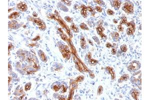 Formalin-fixed, paraffin-embedded human Pancreas stained with CFTR Monoclonal Antibody (CFTR/1341). (CFTR antibody)