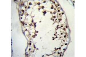 Immunohistochemistry analysis in human testis tissue (Formalin-fixed, Paraffin-embedded) using PIH1D2  Antibody  (C-term), followed by peroxidase conjugated secondary antibody and DAB staining. (PIH1D2 antibody  (C-Term))