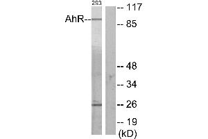 Immunohistochemistry analysis of paraffin-embedded human thyroid gland tissue using AhR (Ab-36) antibody. (Aryl Hydrocarbon Receptor antibody)