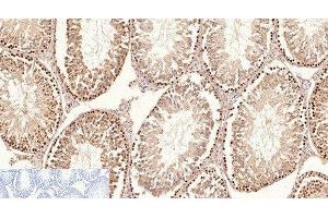 Immunohistochemistry of paraffin-embedded Rat testis tissue using Proliferating Cell Nuclear Antigen Monoclonal Antibody at dilution of 1:200. (PCNA antibody)
