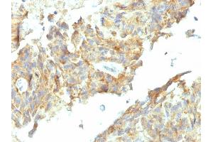 Immunohistochemistry (IHC) image for anti-Alkaline Phosphatase, Liver/bone/kidney (ALPL) antibody (ABIN6939448)