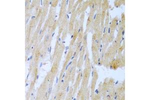 Immunohistochemistry of paraffin-embedded rat heart using UBE2L3 antibody.