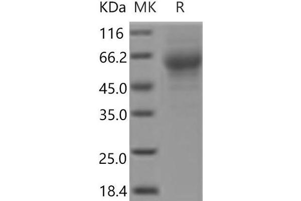 HEPACAM2 Protein (His tag)