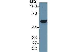 Western blot analysis of Human HeLa cell lysate, using Rat FSCN Antibody (1 µg/ml) and HRP-conjugated Goat Anti-Rabbit antibody (