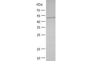 Western Blotting (WB) image for Laminin, alpha 5 (LAMA5) (AA 3027-3482) protein (His tag) (ABIN7284363) (Laminin alpha 5 Protein (AA 3027-3482) (His tag))