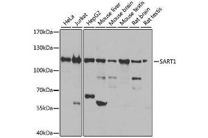 Western blot analysis of extracts of various cell lines, using SART1 antibody. (SART1 antibody  (AA 1-255))
