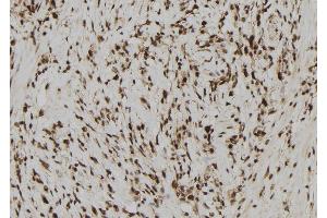 ABIN6278399 at 1/100 staining Human gastric tissue by IHC-P. (RAE1 antibody  (C-Term))