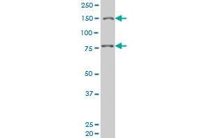 LRRFIP1 monoclonal antibody (M08), clone 3E1 Western Blot analysis of LRRFIP1 expression in Hela S3 NE . (LRRFIP1 antibody  (AA 675-784))