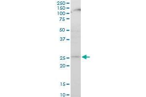 ATG5 monoclonal antibody (M04), clone 1G11. (ATG5 antibody  (AA 176-275))