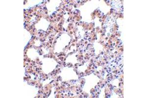 Immunohistochemistry of EIF2AK2 in rat lung tissue with EIF2AK2 polyclonal antibody  at 5 ug/mL .