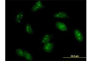 Immunofluorescence of purified MaxPab antibody to UPF3A on HeLa cell. (UPF3A antibody  (AA 1-443))