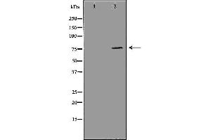 Western blot analysis of MDA MB 361 cell lysate, using ATF6 Antibody.