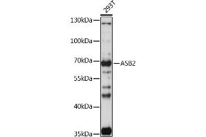 Western blot analysis of extracts of 293T cells, using  antibody (ABIN7265612) at 1:1000 dilution. (ASB2 antibody  (AA 448-587))