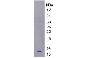 Image no. 1 for S100 Calcium Binding Protein A8 (S100A8) (AA 1-93) protein (His tag) (ABIN1080751) (S100A8 Protein (AA 1-93) (His tag))