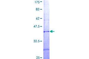 Image no. 1 for Signal Peptide Peptidase Like 2C (SPPL2C) (AA 29-122) protein (GST tag) (ABIN1307881) (SPPL2C Protein (AA 29-122) (GST tag))