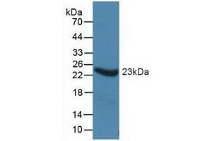 Detection of Recombinant a1AGP, Human using Monoclonal Antibody to Alpha-1-Acid Glycoprotein (a1AGP) (ORM1 antibody  (AA 19-201))