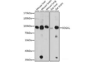 Western blot analysis of extracts of various cell lines using SOGA1 Polyclonal Antibody at dilution of 1:1000.