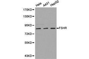 Western Blotting (WB) image for anti-Follicle Stimulating Hormone Receptor (FSHR) antibody (ABIN1872742) (FSHR antibody)