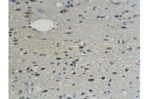 Formalin-fixed and paraffin embedded mouse brain labeled with Anti-Sphingomyelin Synthase 1 Polyclonal Antibody, Unconjugated  followed by conjugation to the secondary antibody and DAB staining (Sphingomyelin Synthase 1 antibody  (AA 331-413))