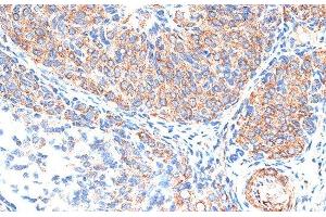 Immunohistochemistry of paraffin-embedded Rat ovary using TIMP2 Polyclonal Antibody at dilution of 1:100 (40x lens).