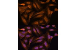 Immunofluorescence analysis of U-2 OS cells using MEK3 antibody (ABIN6130544, ABIN6143484, ABIN6143485 and ABIN6223650) at dilution of 1:100.