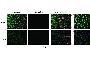 BOP1 expression is decreased in ASMCs of AD patients. (8-OHDG antibody)