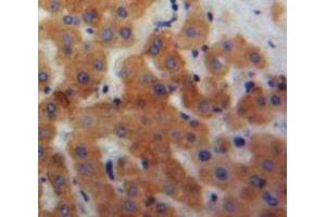IHC-P analysis of Liver tissue, with DAB staining. (Ficolin 2 antibody  (AA 97-254))