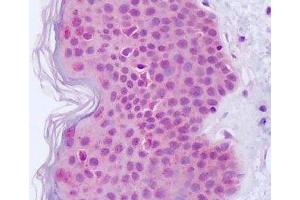 Anti-EGFR antibody IHC staining of human skin. (EGFR antibody)
