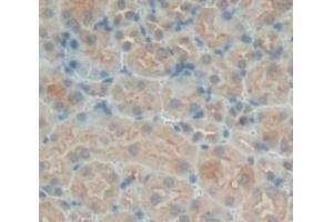 Used in DAB staining on fromalin fixed paraffin- embedded Kidney tissue (SNX18 antibody  (AA 411-614))