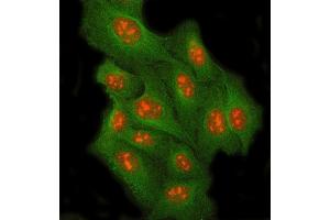 IF analysis of RRP8 and Tubulin beta using anti-RRP8 antibody (ABIN7600459) and anti-Tubulin beta antibody (ABIN7602744). (RRP8 antibody  (AA 199-456))