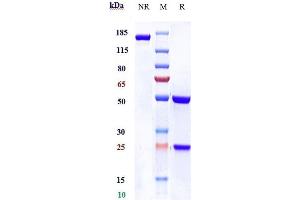Anti-IL-1R1 / CD121a Reference Antibody (AMG 108) on SDS-PAGE under reducing (R) condition.