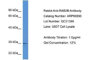 Western Blotting (WB) image for anti-RAB2B, Member RAS Oncogene Family (RAB2B) (C-Term) antibody (ABIN786242) (RAB2B antibody  (C-Term))