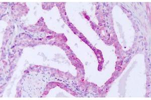 Image no. 2 for anti-serine/threonine Kinase 33 (STK33) (AA 34-83) antibody (ABIN6749787) (STK33 antibody  (AA 34-83))