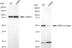 Western blotting analysis using ZPR1 zinc finger antibody (ABIN7800895). (Recombinant ZNF259 antibody)