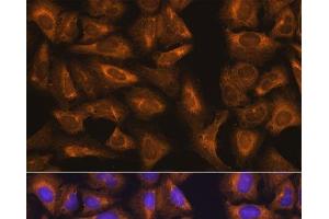 Immunofluorescence analysis of U-2 OS cells using RPL17 Polyclonal Antibody at dilution of 1:100. (RPL17 antibody)