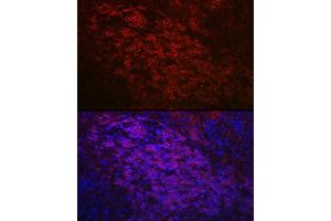 Immunofluorescence analysis of mouse spleen using CD79a Rabbit pAb (ABIN1679100, ABIN3015116, ABIN3015118 and ABIN6213808) at dilution of 1:50 (40x lens). (CD79a antibody  (AA 33-145))