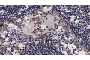 ABIN6266817 at 1/100 staining human Lymph node tissue sections by IHC-P. (NT5C3 antibody  (N-Term))