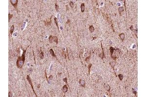 ABIN6266954 at 1/100 staining human brain tissue sections by IHC-P.