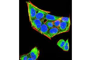 Immunofluorescence analysis of Hela cells using Rab5a mouse mAb (green). (RAB5 antibody  (AA 1-215))