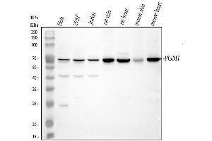 Western blot analysis of PGM1 using anti-PGM1 antibody (ABIN7599474).