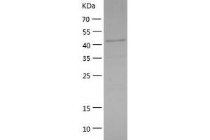 Western Blotting (WB) image for GATA Binding Protein 1 (Globin Transcription Factor 1) (GATA1) (AA 2-413) protein (His tag) (ABIN7285455) (GATA1 Protein (AA 2-413) (His tag))