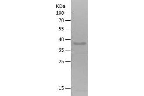 CD56 Protein (AA 344-619) (His tag)