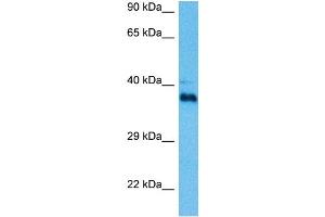 Host:  Mouse  Target Name:  PITX1  Sample Tissue:  Mouse Spleen  Antibody Dilution:  1ug/ml