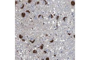 Immunohistochemical staining of human hippocampus with CYP2W1 polyclonal antibody  shows strong cytoplasmic positivity, with a granular pattern, in neuronal and glial cells.