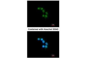 ICC/IF Image Immunofluorescence analysis of methanol-fixed HepG2, using STXBP2, antibody at 1:200 dilution. (STXBP2 antibody)