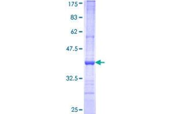BMP8B Protein (AA 274-362) (GST tag)