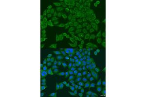 Immunofluorescence analysis of U2OS cells using PIWIL1 antibody (ABIN2564557) at dilution of 1:100. (PIWIL1 antibody)
